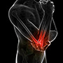 Lateral Ulnar Collateral Ligament