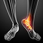 Treatment of Foot and Ankle Sports Injuries